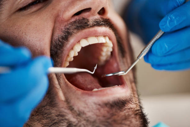 Best Emergency Tooth Extraction in Obetz, OH